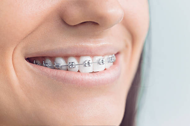 Best Invisalign and Clear Aligners  in Jerseyvle, IL